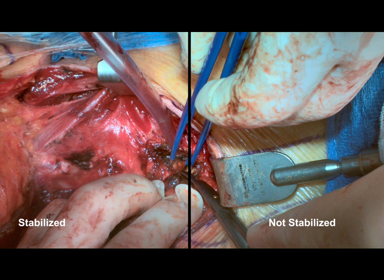 智能防抖云台 主动防抖
