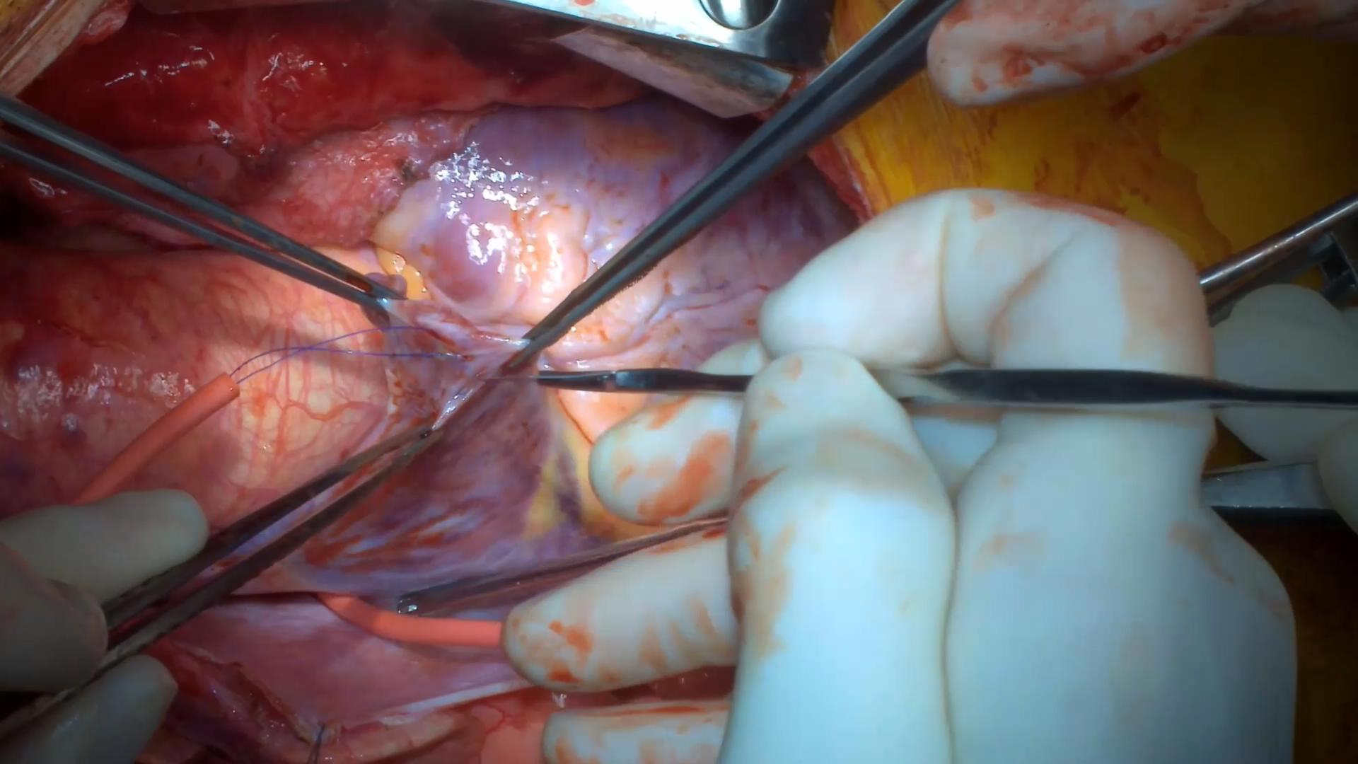 专业级光学变焦，视野收放自如